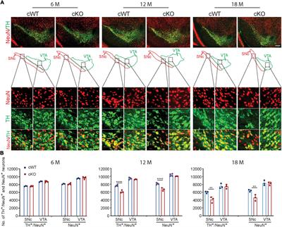 Pitx3 deficiency promotes age-dependent alterations in striatal medium spiny neurons